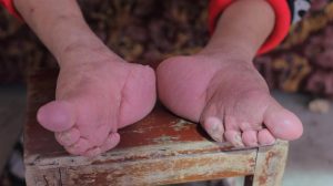 بستن پا با پابند در چین